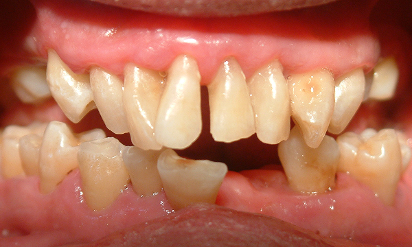 periodontal_image01