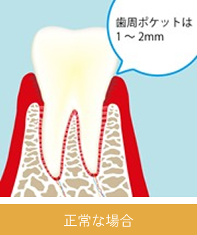 periodontal_image02