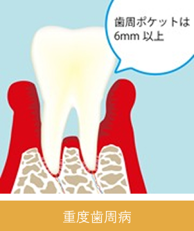 periodontal_image06