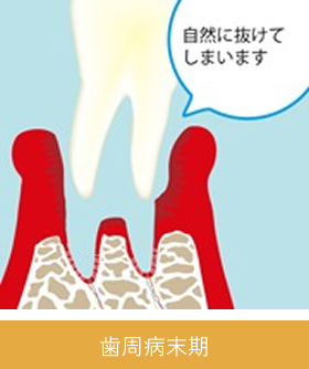 periodontal_image07