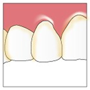 preventive_image02