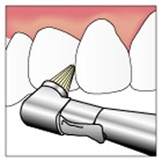 preventive_image02