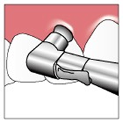 preventive_image02