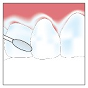 preventive_image02